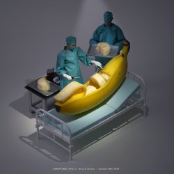 バナナ 手術 Banana Surgery
